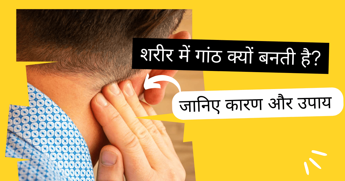 शरीर में गांठ क्यों बनती है?